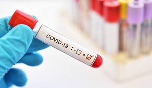 भारत में कोविड-19 के 2,380 नए मामले सामने आए, उपचाराधीन मरीजों की संख्या घटकर 27,212 हुई