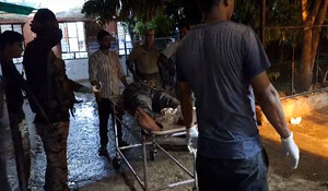 Dholpur News: डकैतों और पुलिस के बीच हुई मुठभेड़, एक डकैत के पैर में गोली लगी; 2 साथी भी घायल